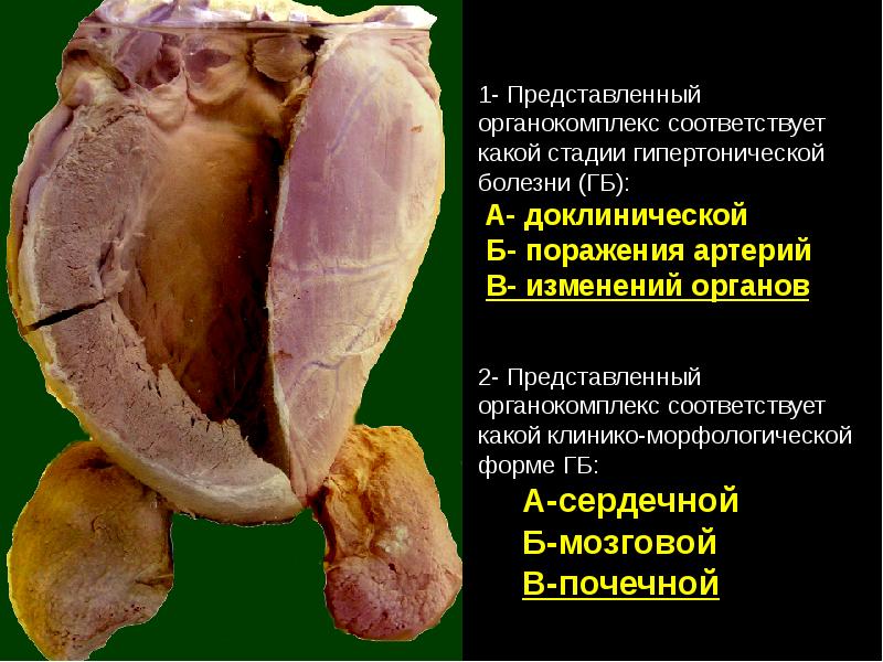 Болезни органов дыхания презентация патанатомия