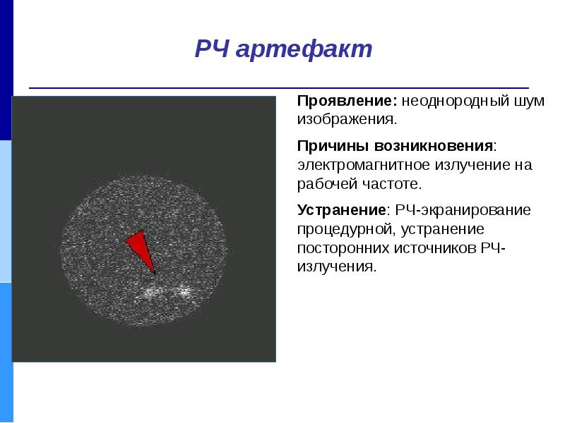 Артефакты сжатия изображения