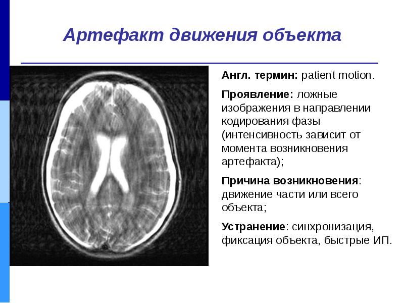 Артефакты в проекте это