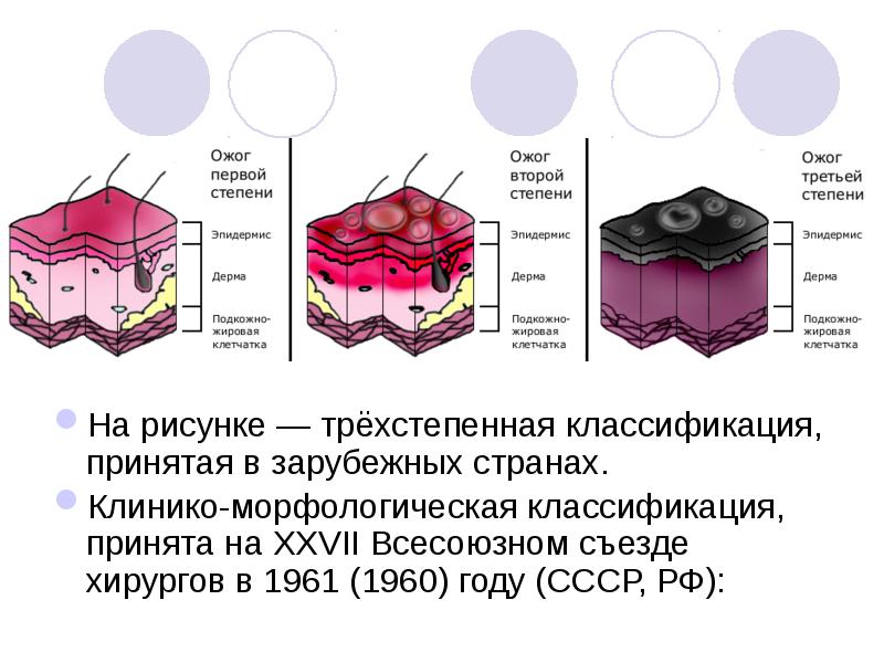 Ожоги и отморожения у детей презентация