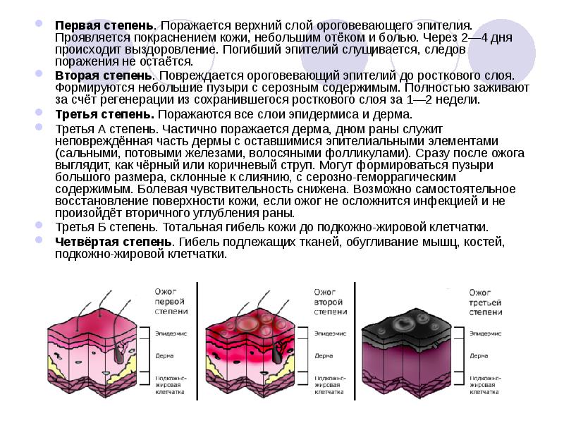 Ожоги и отморожения у детей презентация