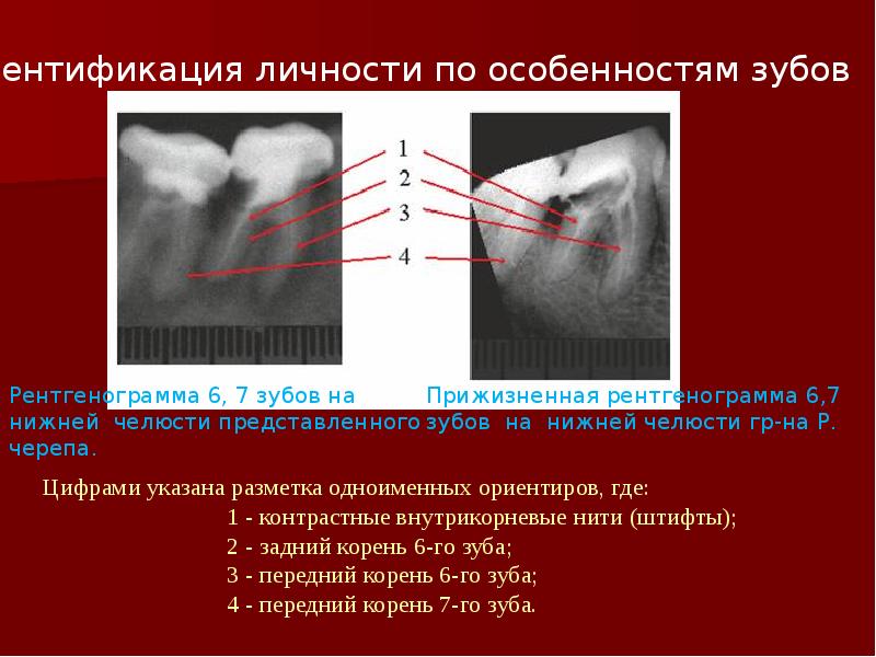 Судебная медицина презентация