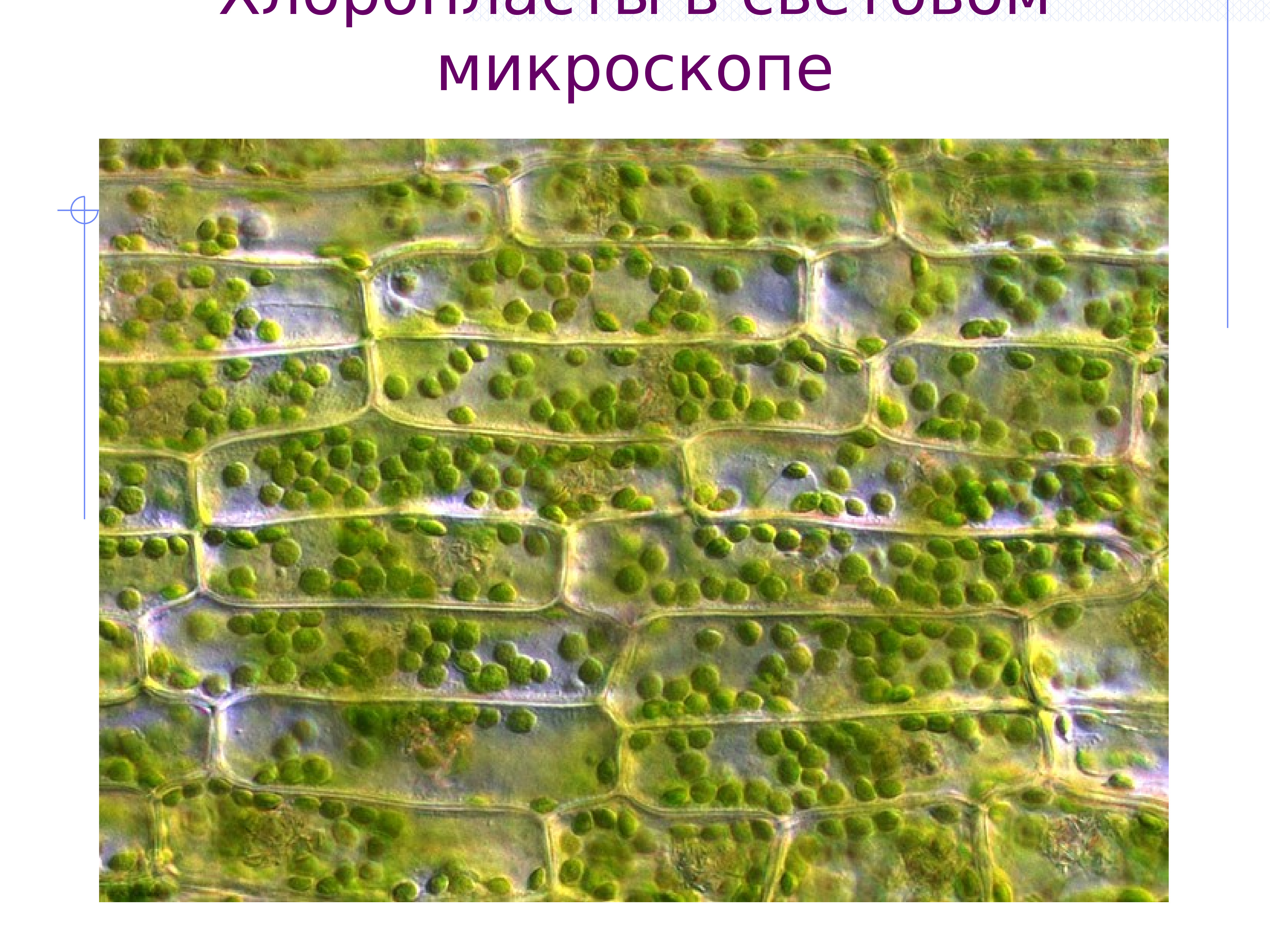 Растительная клетка под микроскопом. Хлоропласты элодеи. Клетка элодеи. Хлоропласты в листе элодеи. Пластиды элодеи.