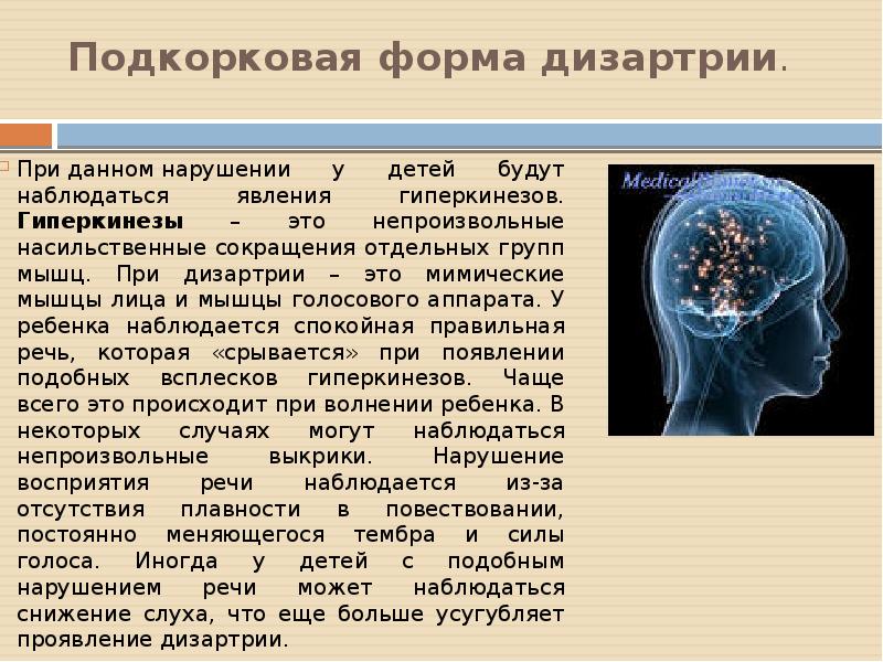 Проект по дизартрии