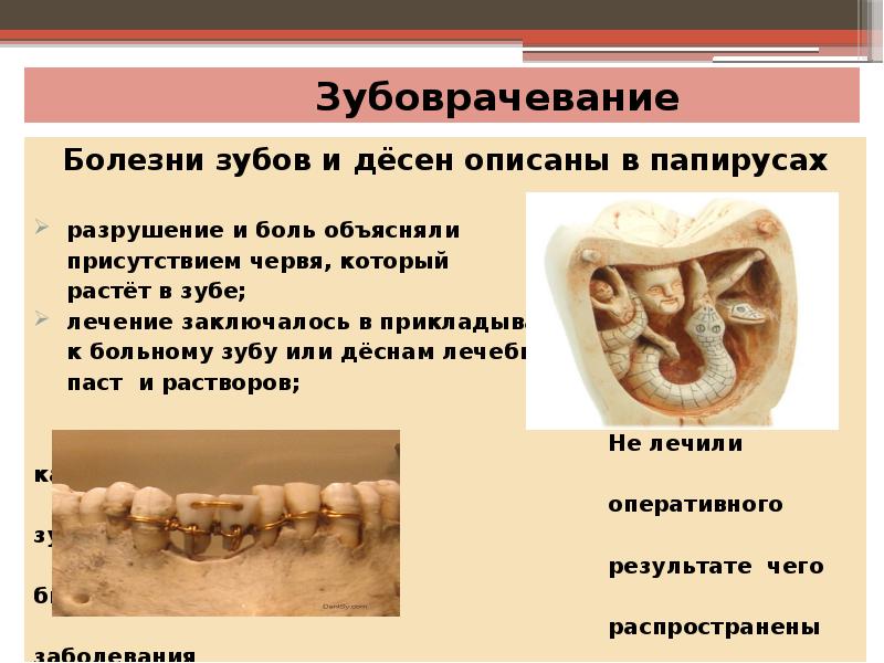Зубоврачевание Зубоврачевание
