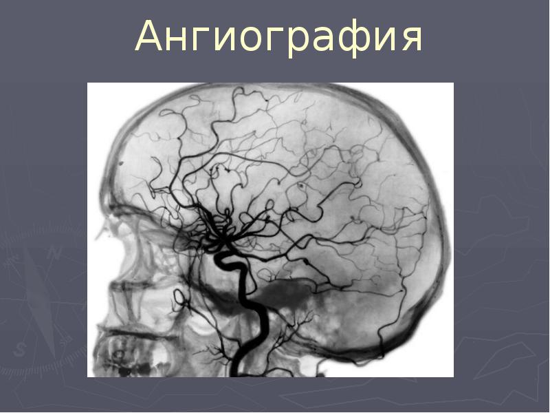 Презентация на тему нейрохирургия