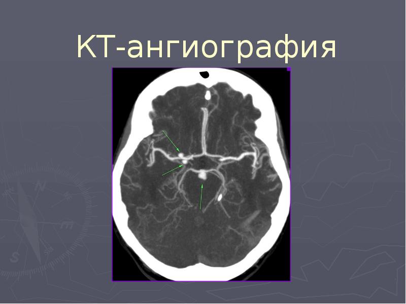 Презентация на тему нейрохирургия