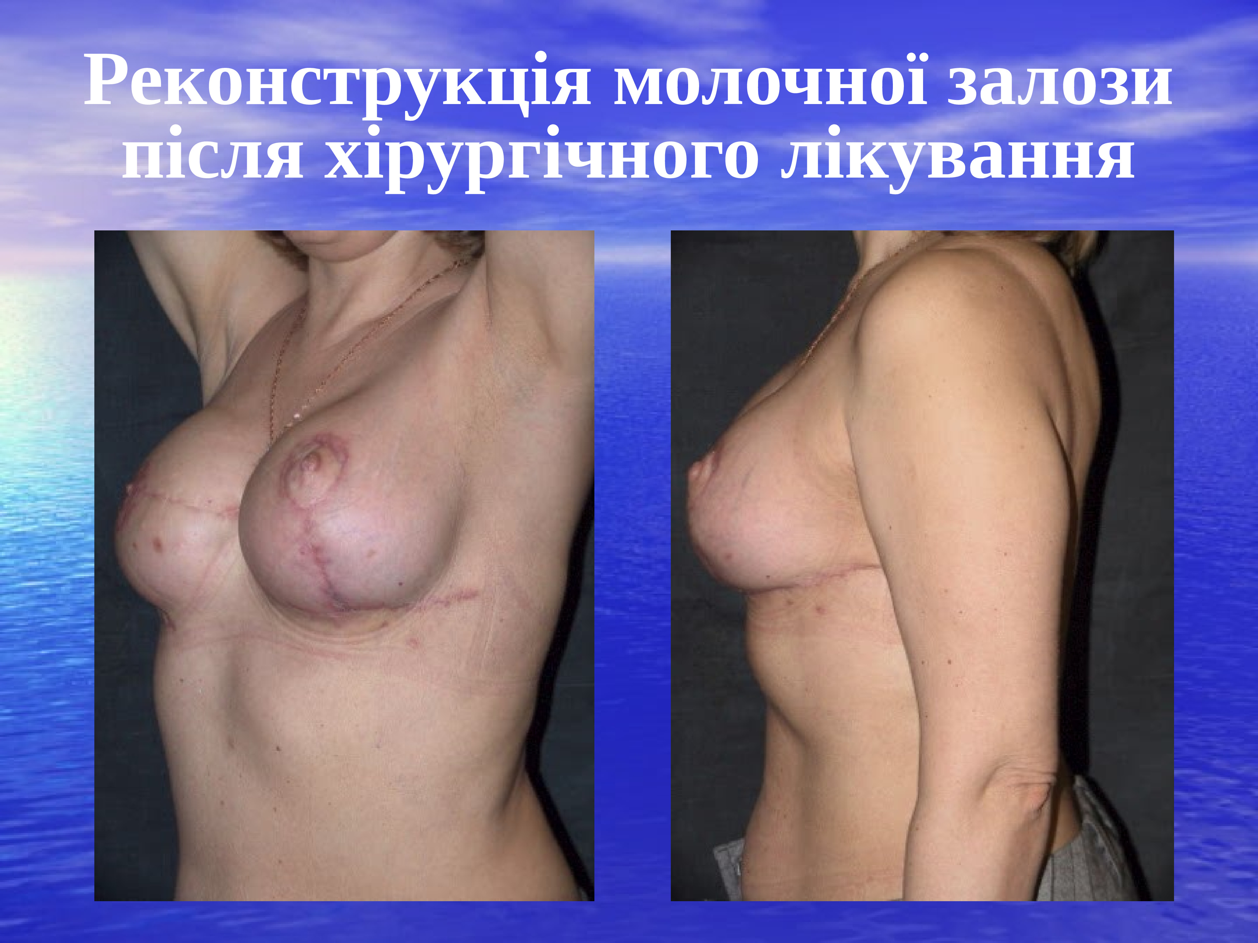 форум грудь после беременности фото 12