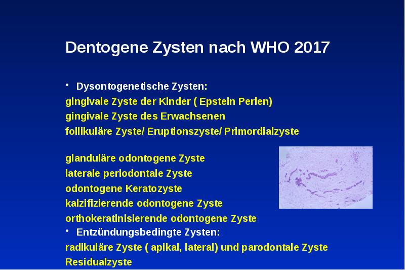 Dentogene Zysten nach WHO 2017
Dysontogenetische Zysten:
gingivale Zyste der Kinder Dentogene Zysten nach WHO 2017
Dysontogenetische Zysten:
gingivale Zyste der Kinder