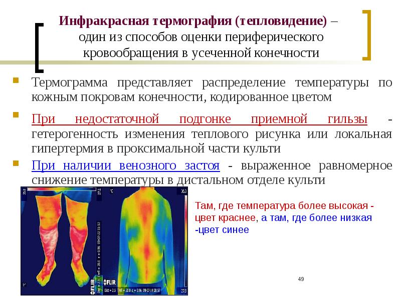 Медицинская термография презентация