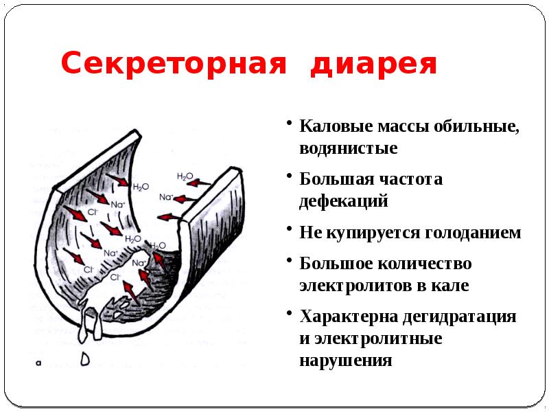 Механизмы диареи. Секреторная диарея патогенез. Механизм секреторной диареи. Укажите заболевания с секреторным типом диареи. Секреторная диарея патогенез схема.