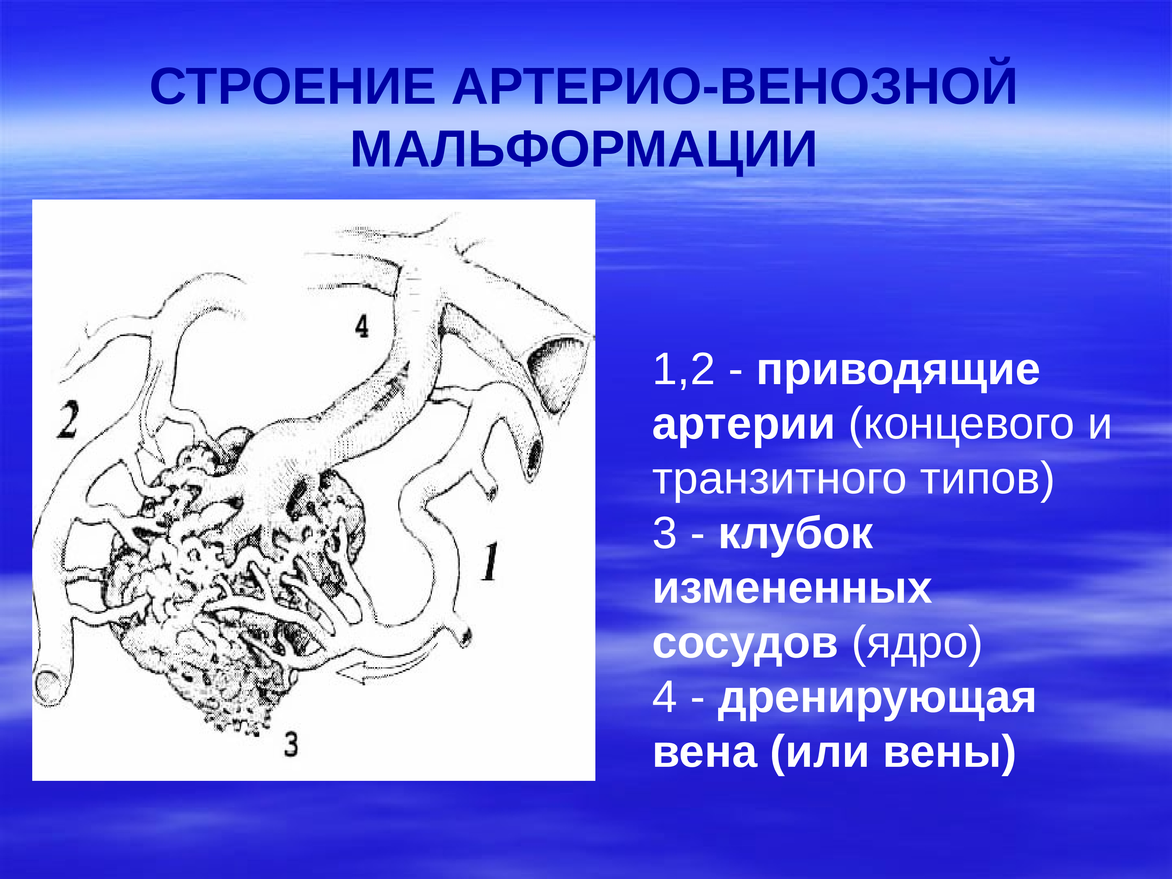 Презентация на тему нейрохирургия