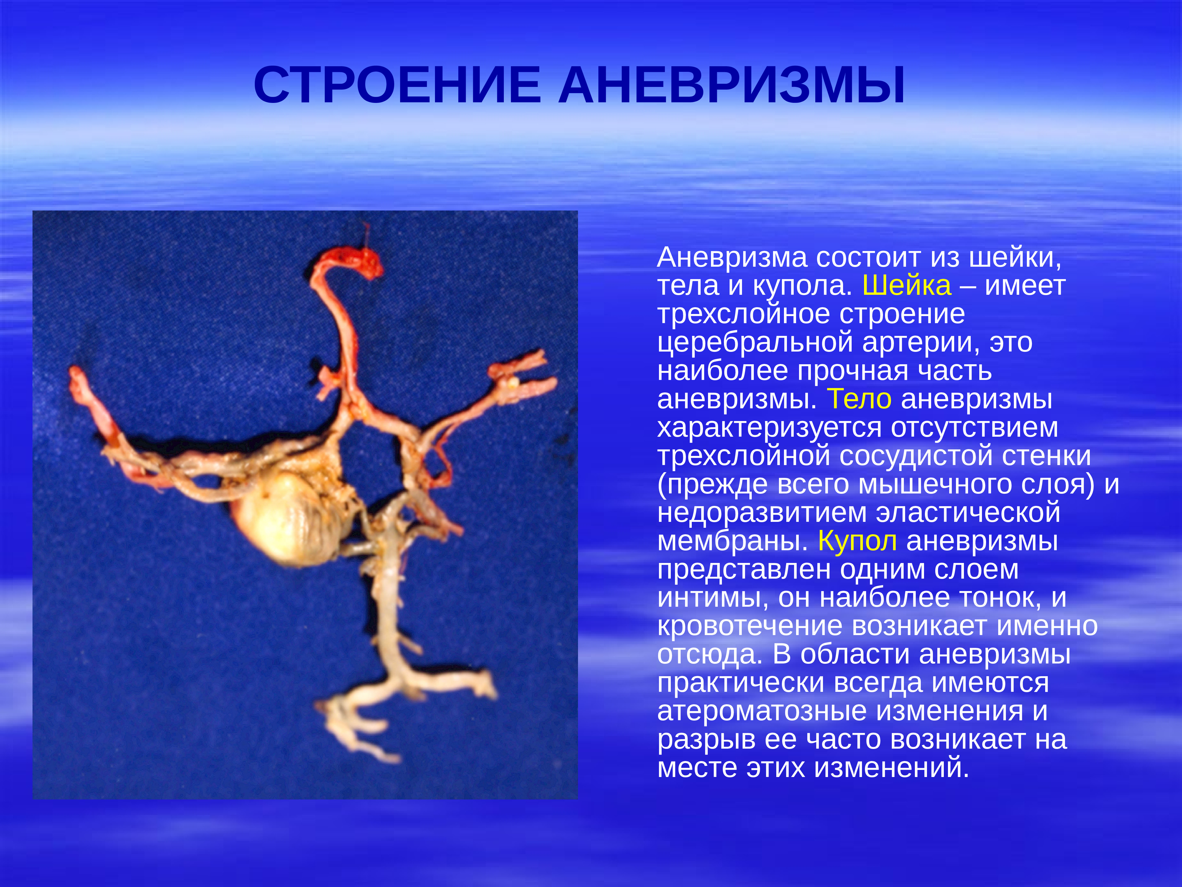 Аневризма. Строение артериальной аневризмы. Аневризма презентация. Микотические аневризмы.