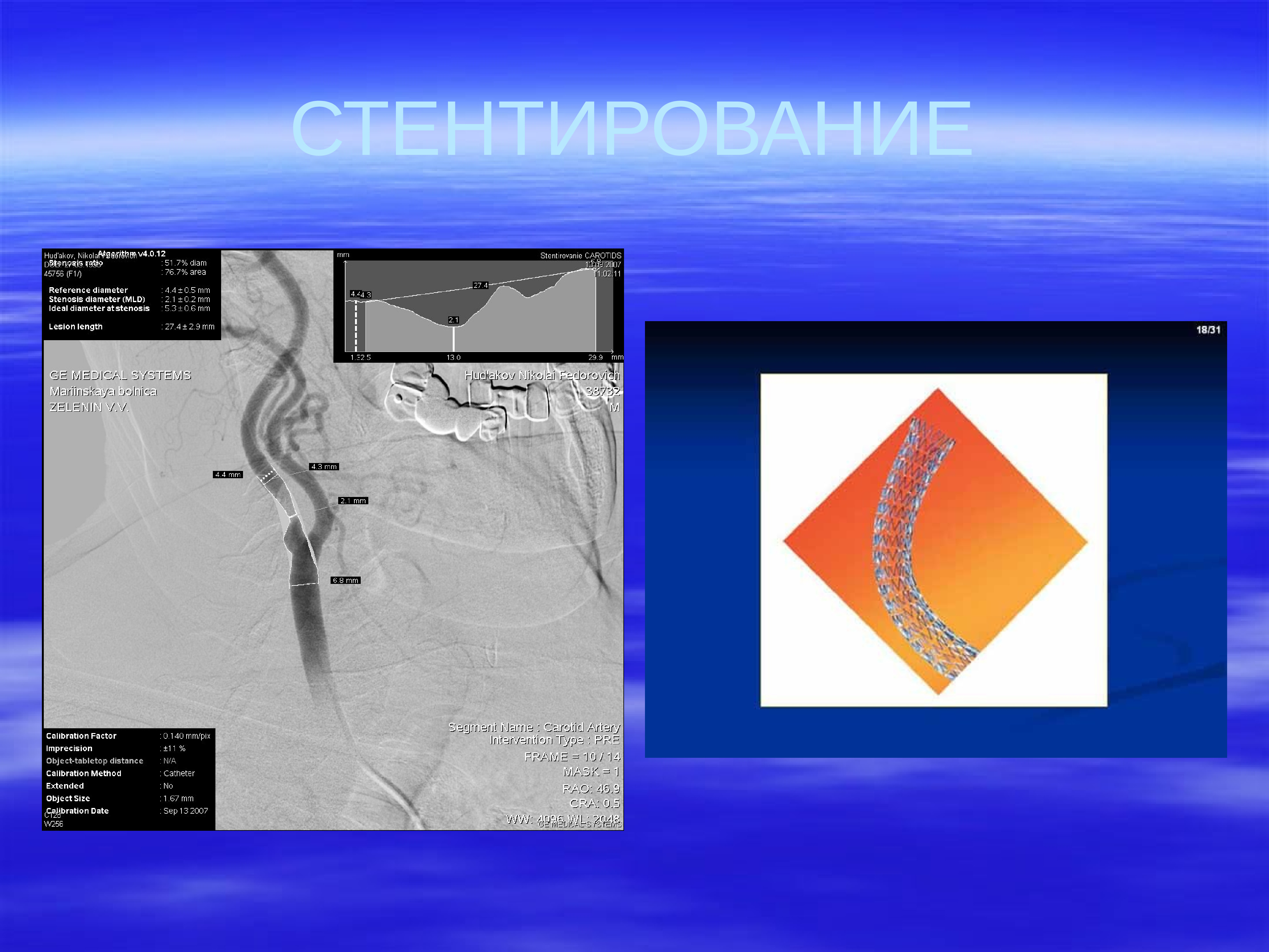 Презентация на тему нейрохирургия