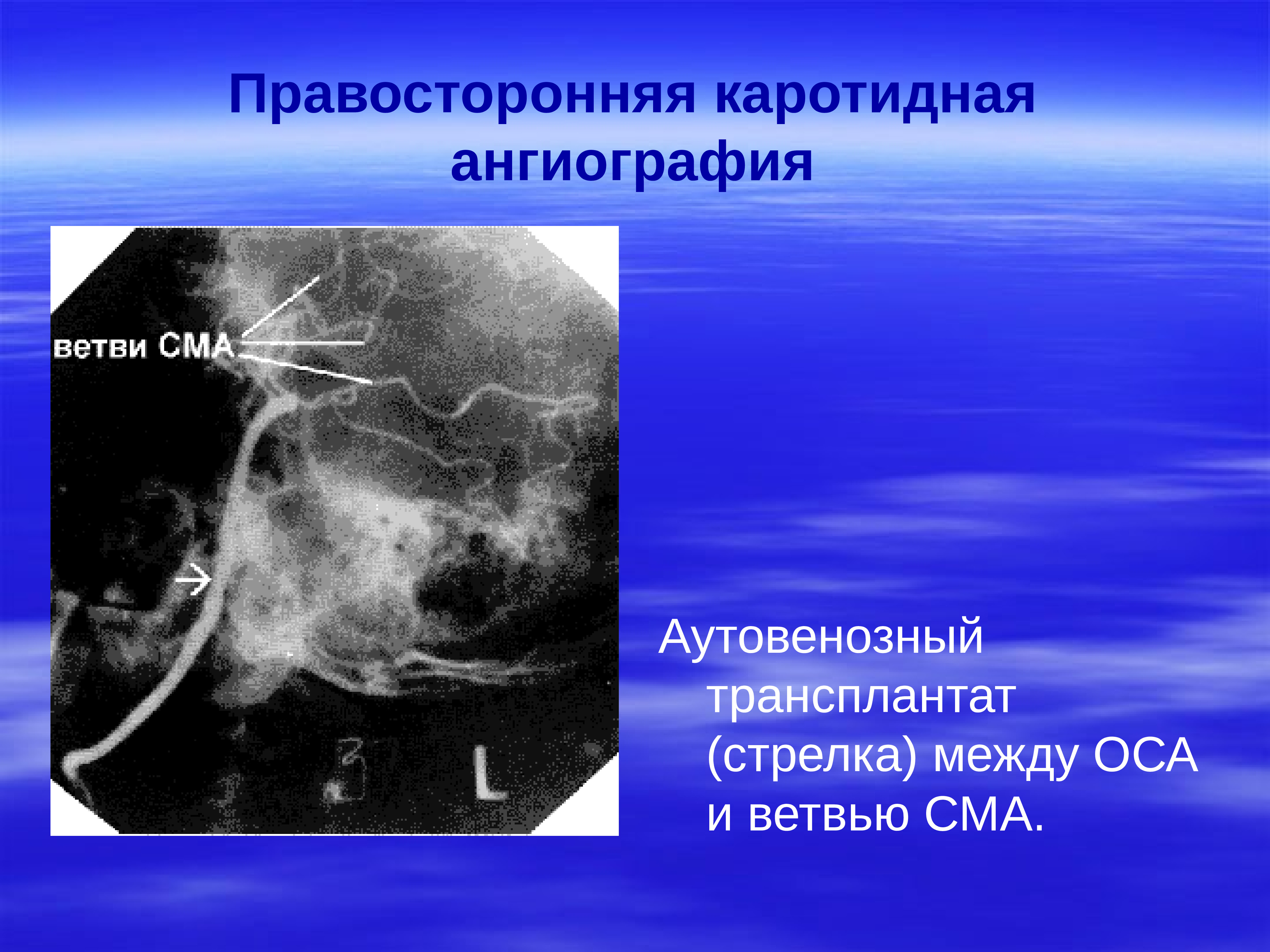 Презентация на тему нейрохирургия