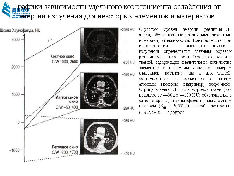 Шкала хаунсфилда презентация