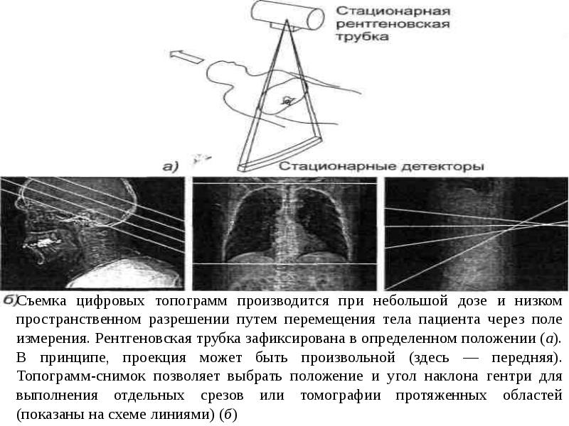 Рентгеновская компьютерная томография презентация