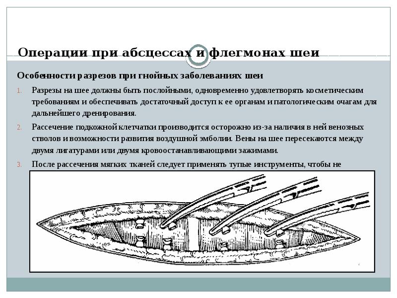 Презентация операции на шее