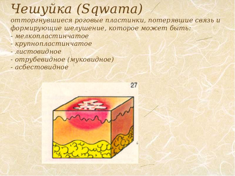 Морфологические элементы кожи презентация