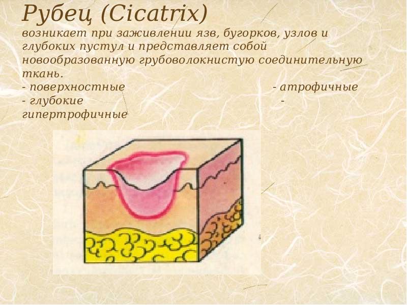 Первичные морфологические элементы презентация