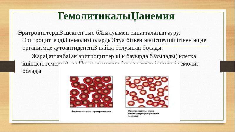 Анемиялар қазақша презентация