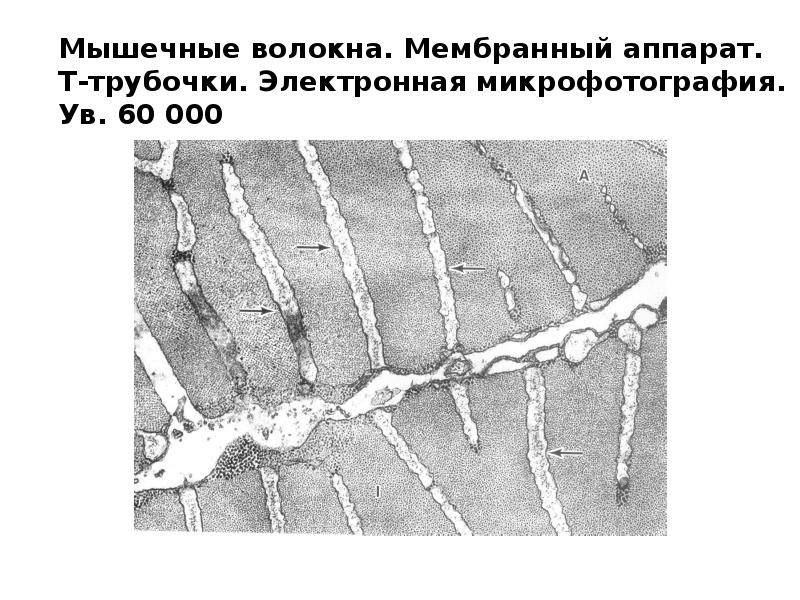 Мышечные ткани презентация