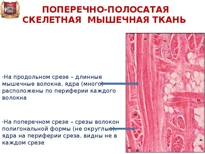 Волокна мышечной ткани. Поперечнополосатая мышечная ткань продольный срез мышечных волокон. Поперечно полосатая мышечная ткань продольный и поперечный срез. Волокна поперечно-полосатой скелетной ткани. Продольный срез скелетной мышечной ткани.