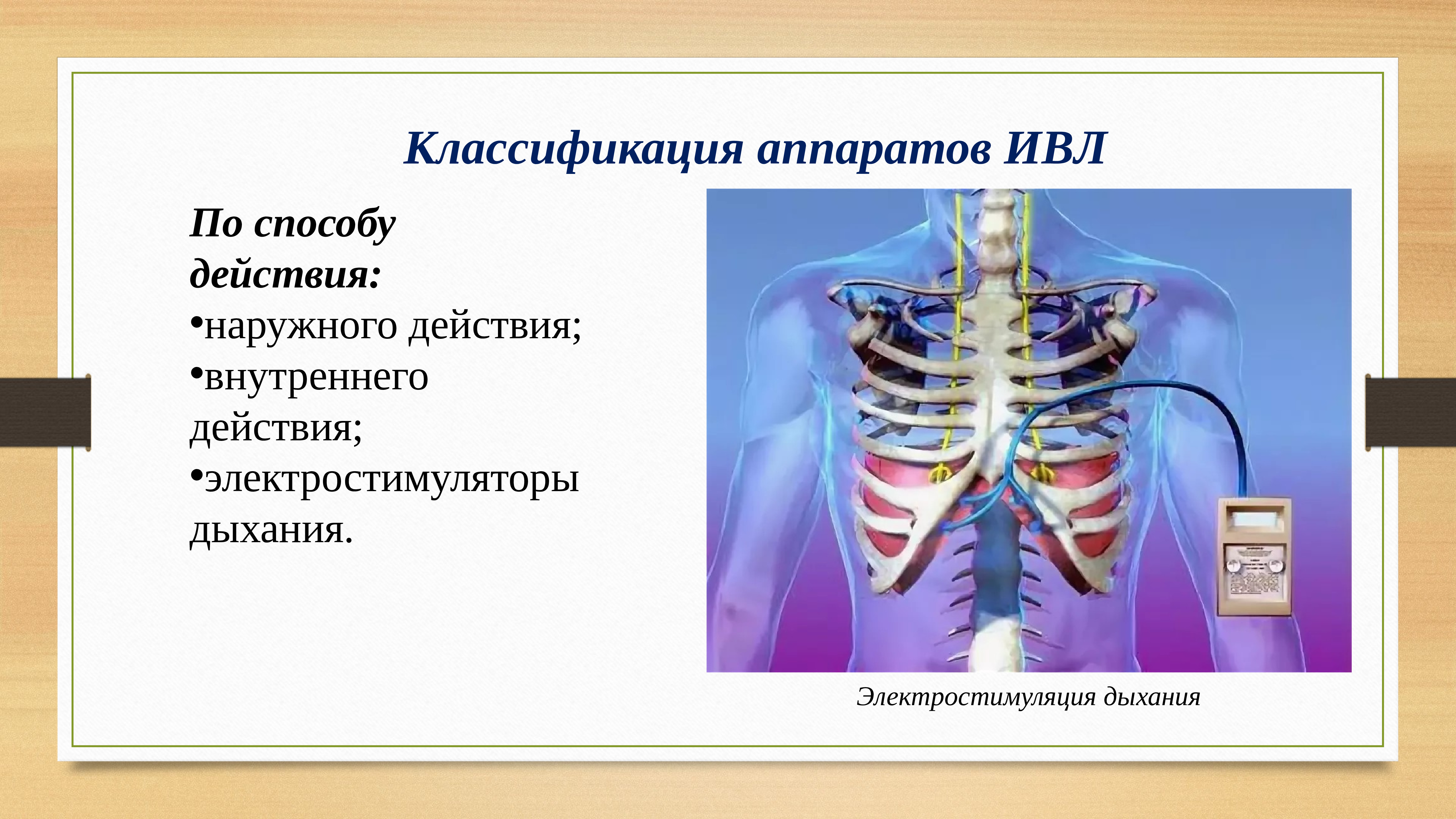 Дыхание 5 групп. Классификация аппаратов ИВЛ. Искусственная вентиляция лёгких. Классификация искусственной вентиляции. Классификация методов ИВЛ.