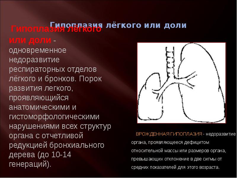 Гипоплазия легкого презентация