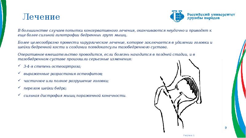 Лечение
В большинстве случаев попытки консервативного лечения, оканчиваются неудачно и приводят Лечение
В большинстве случаев попытки консервативного лечения, оканчиваются неудачно и приводят
