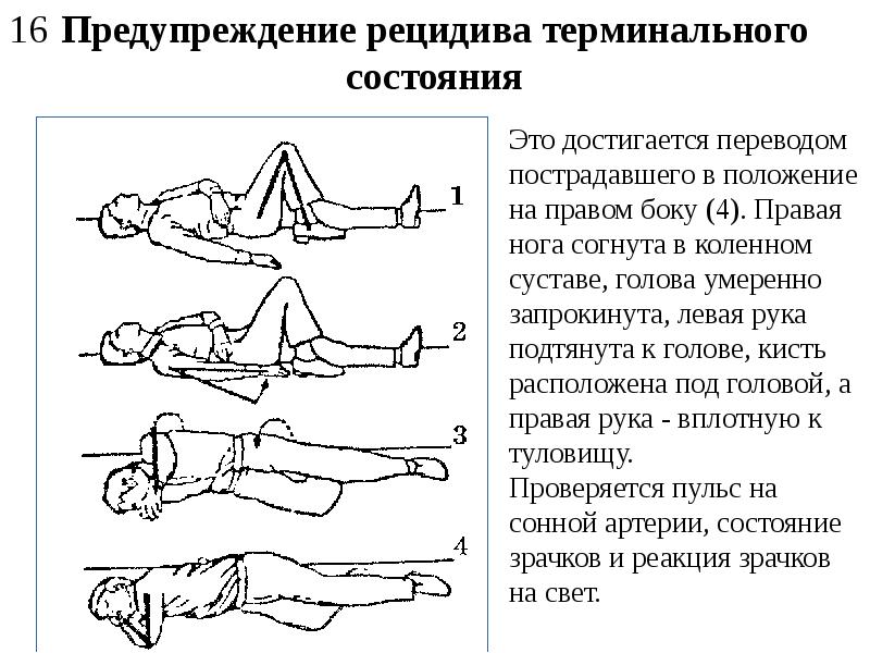 Положение на боку. Положение пострадавшего на боку. Профилактика терминальных состояний. Предупреждение рецидива терминального состояния.