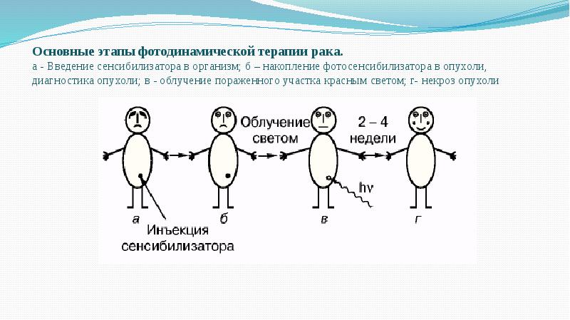 Основные этапы фотодинамической терапии рака. а - Введение сенсибилизатора в организм; Основные этапы фотодинамической терапии рака. а - Введение сенсибилизатора в организм;