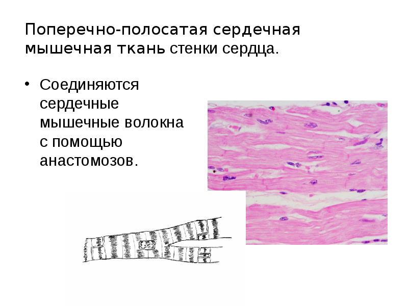 Особенности поперечно полосатой сердечной. Волокна поперечно-полосатой сердечной мышечной ткани. Строение поперечно полосатой сердечной мышечной ткани. Сердечная поперечно-полосатая мышечная функции. Поперечно-полосатая сердечная мышечная ткань препарат.