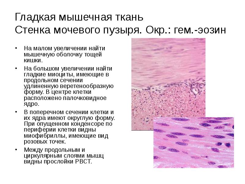 Гладкая мышечная. Гладкая мышечная ткань стенки мочевого пузыря. Гладкая мышечная ткань срез стенки мочевого пузыря. Гладкая мышечная ткань стенки мочевого пузыря препарат. Гладкая мышечная ткань стенки мочевого пузыря гематоксилин эозин.