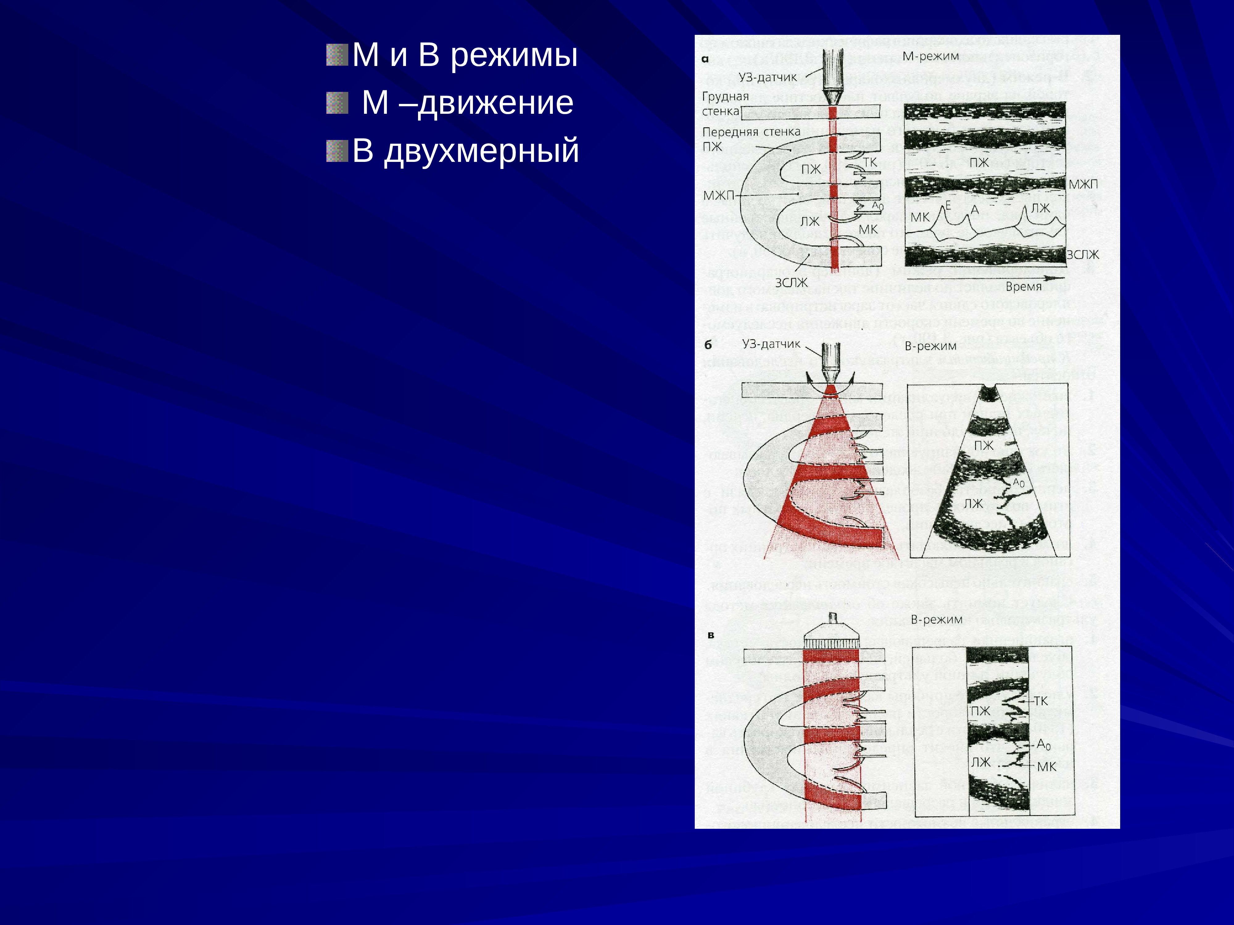 М режим. ЭХОКГ М режим. Эхокардиография м режим. Одномерная ЭХОКГ В М режиме. Режимы ЭХОКГ.