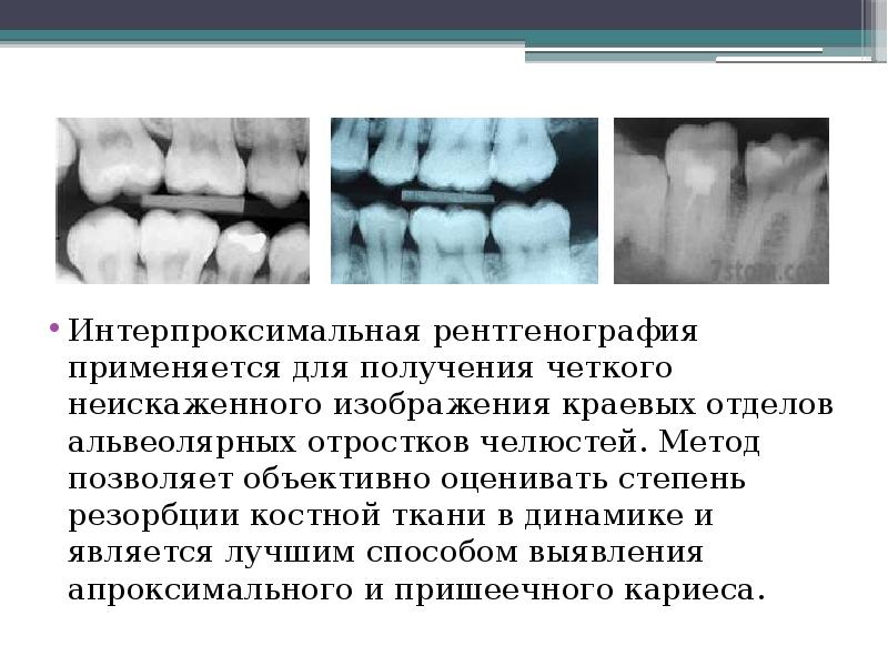 Для получения четкого изображения