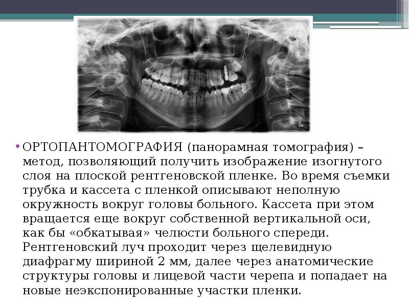 Изображение получаемое на рентгеновской пленке