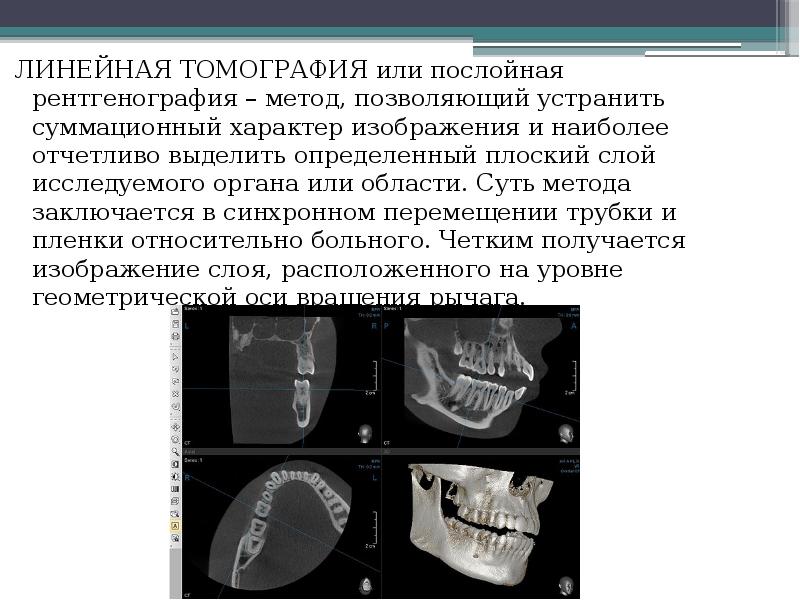 Мрт в стоматологии презентация