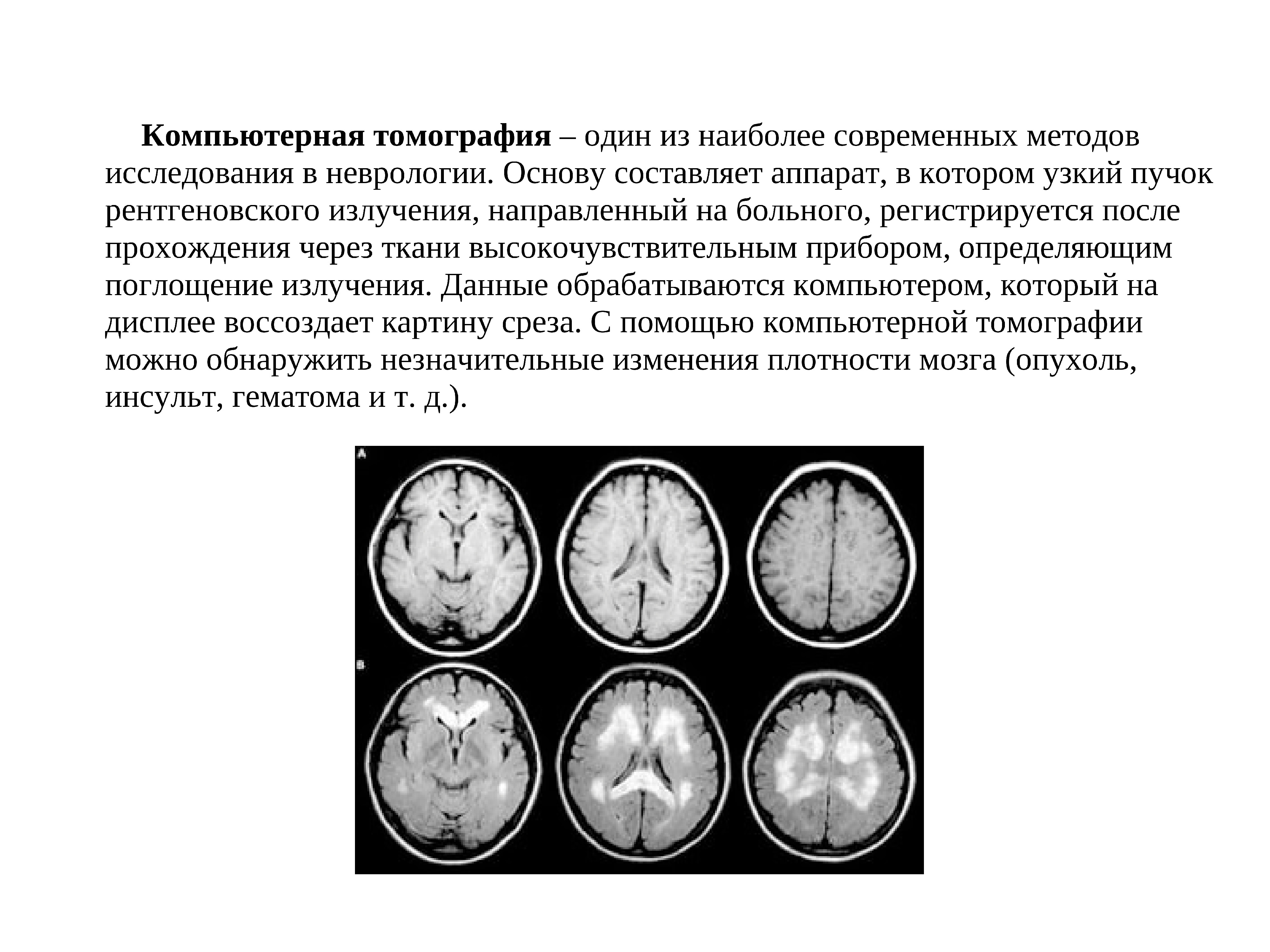 Методы исследования в неврологии презентация