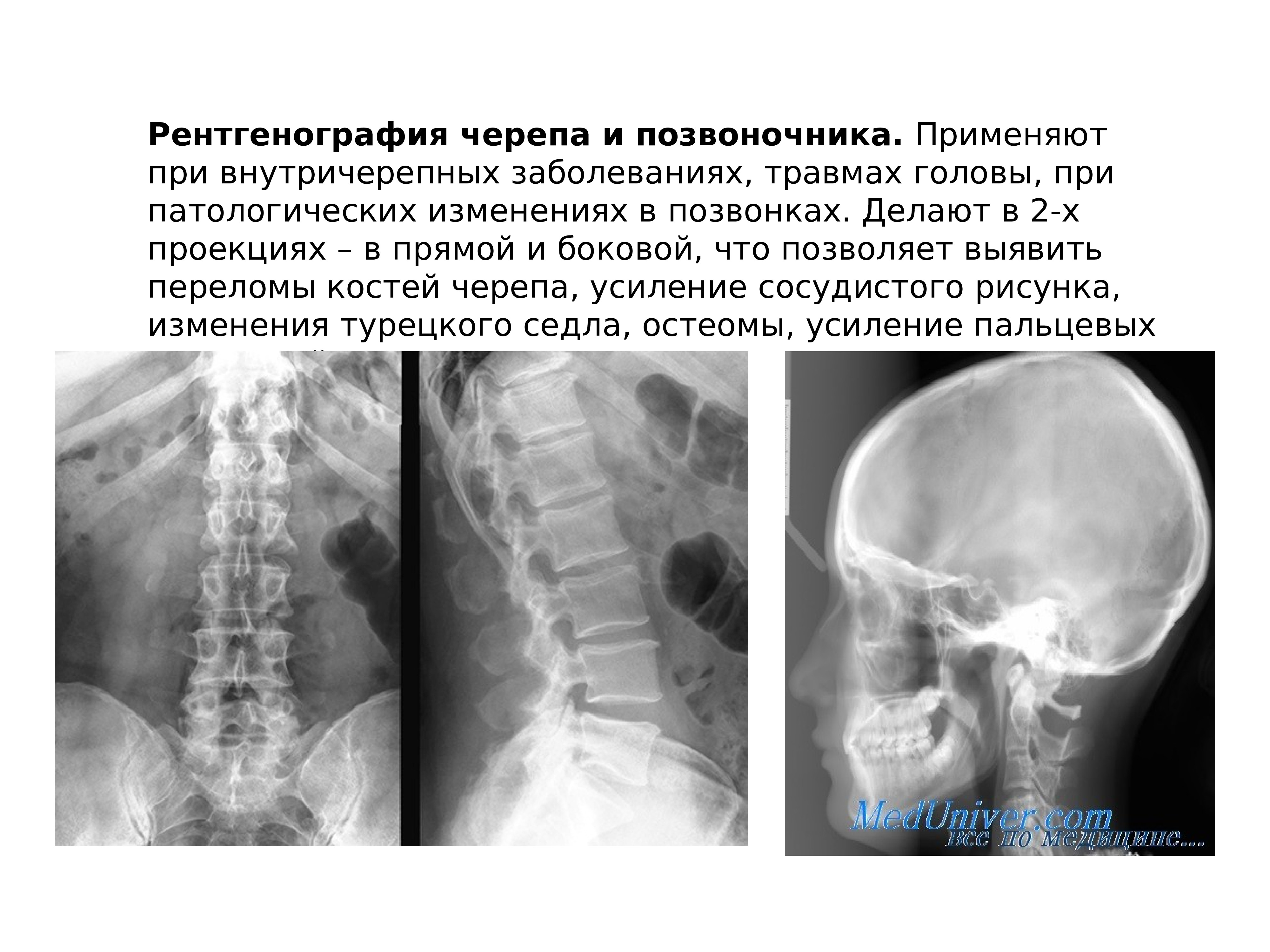 Рентгенография черепа и позвоночника