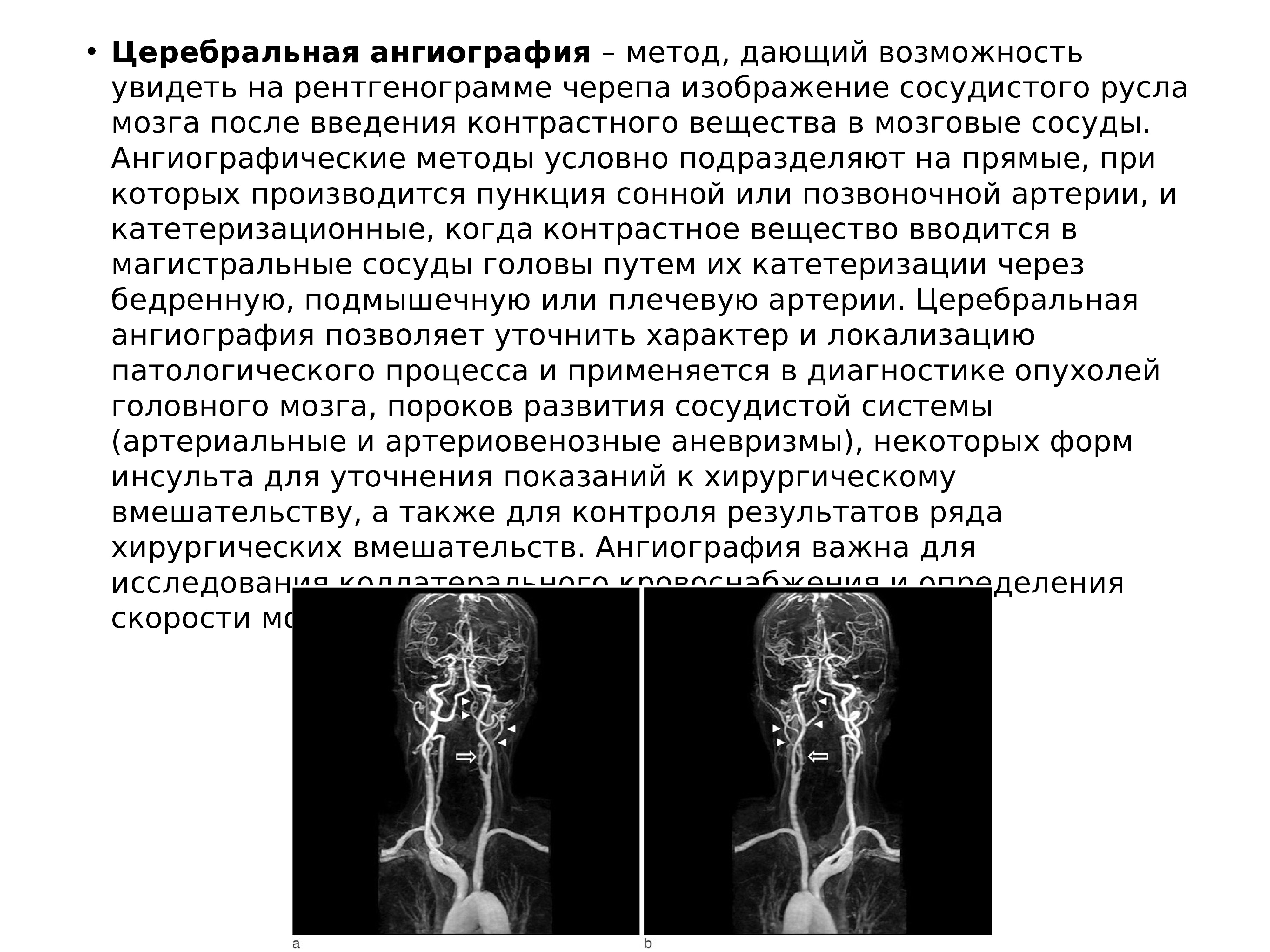 Методы исследования в неврологии презентация