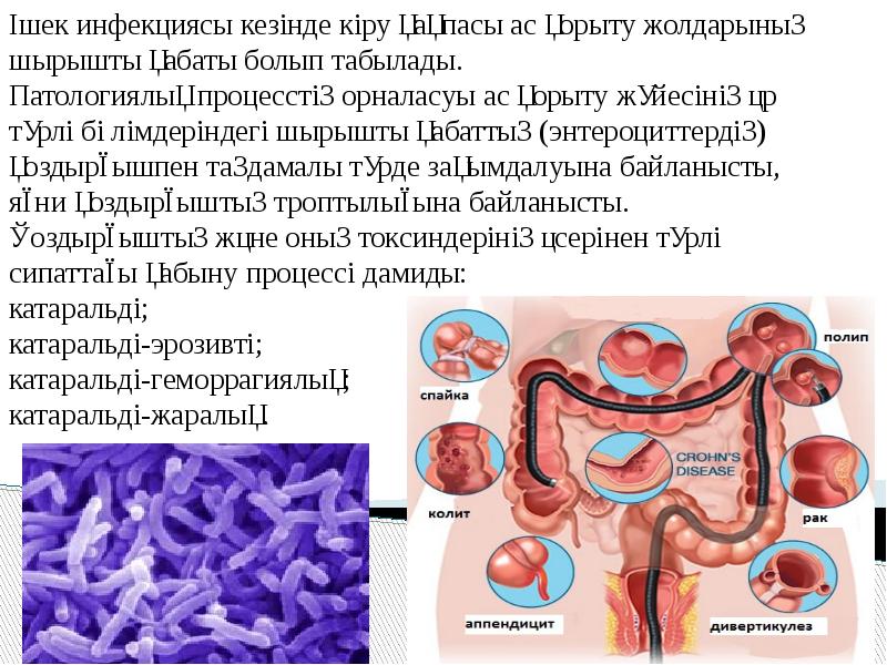 Урологиялық аурулар презентация