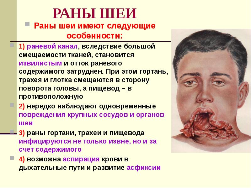 РАНЫ ШЕИ Раны шеи имеют следующие особенности: 1) раневой канал, вследствие