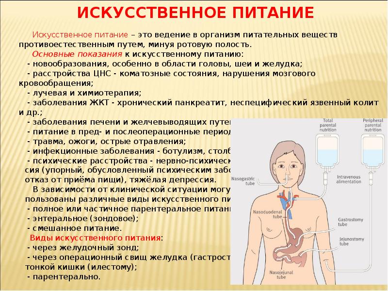 Презентация искусственное питание