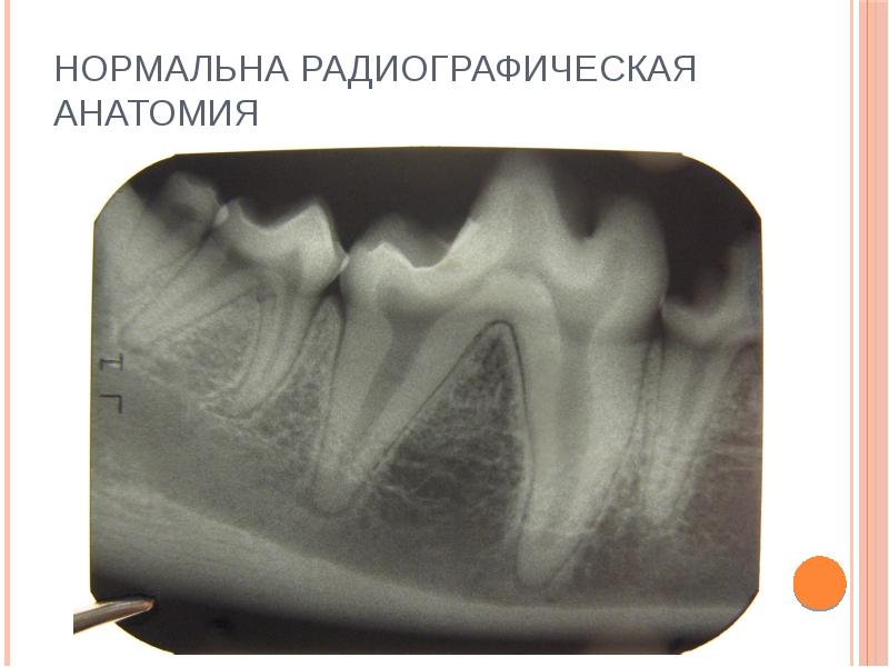 Рентгенография в стоматологии презентация