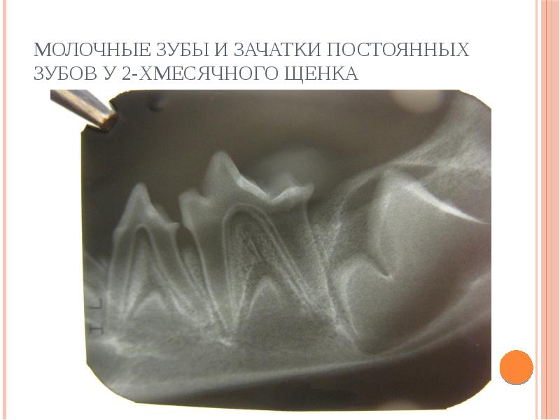 Зеркала внутриротовые для фотографии в стоматологии