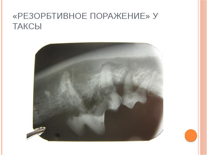 Рентген в стоматологии презентация