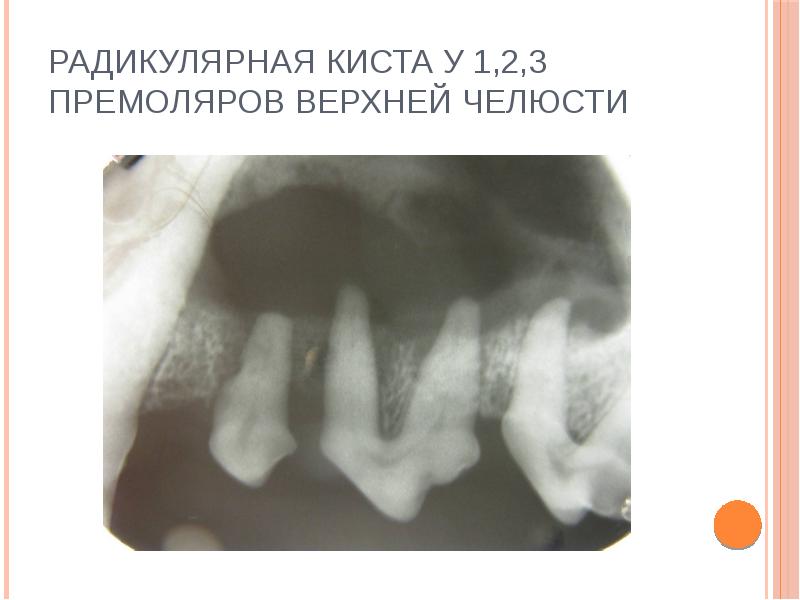 Рентгенография в стоматологии презентация