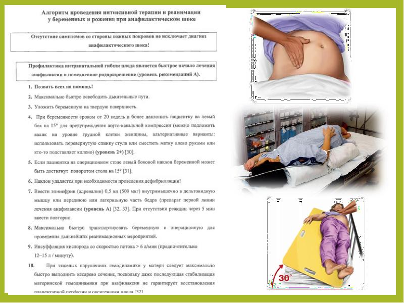 Особенности реанимации у беременных женщин презентация