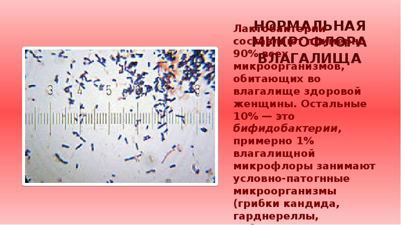 В женском влагалище лактобактерии бифидобактерии. В наддесневой бляшке обитают микробиология. К какой группе относятся микроорганизмы обитающие